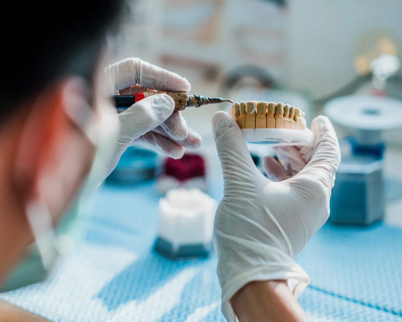 Laboratorio de Prótesis Dental en Madrid