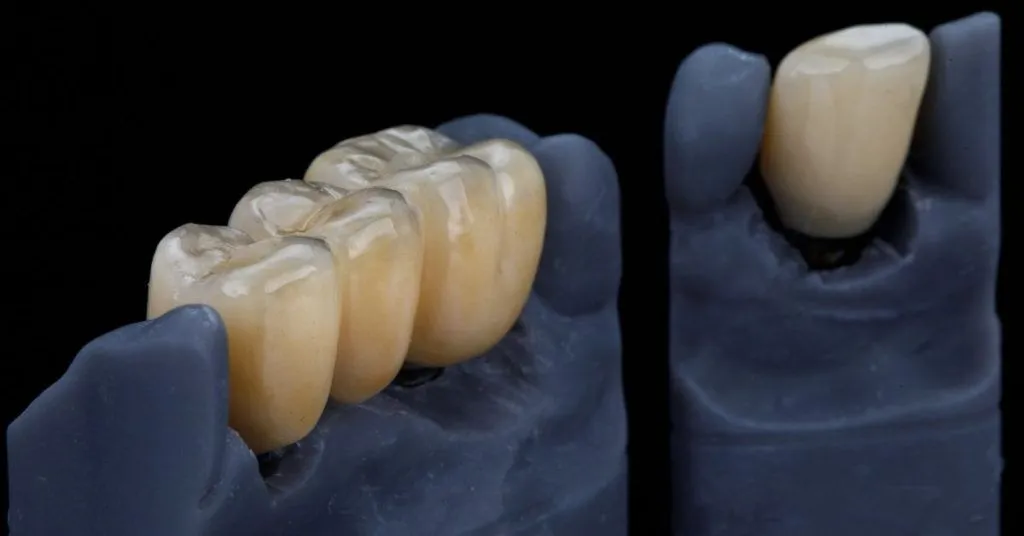 PMMA vs Zirconio en Prótesis Dentales: Diferencias, Ventajas y Cuándo Utilizar Cada Material